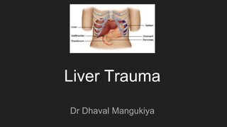 Liver Trauma
Dr Dhaval Mangukiya
 