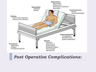 Post Operative Complications:
 