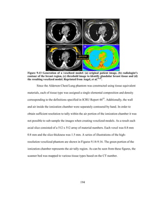 194
Figure 9.13 Generation of a voxelized model: (a) original patient image, (b) radiologist’s
contour of the breast region, (c) threshold image to identify glandular breast tissue and (d)
the resulting voxelized model. Reprinted from Angel, et al.61,62
.
Since the Alderson Chest/Lung phantom was constructed using tissue equivalent
materials, each of tissue type was assigned a single elemental composition and density
corresponding to the definitions specified in ICRU Report 4455
. Additionally, the wall
and air inside the ionization chamber were separately contoured by hand. In order to
obtain sufficient resolution to tally within the air portion of the ionization chamber it was
not possible to sub-sample the images when creating voxelized models. As a result each
axial slice consisted of a 512 x 512 array of material numbers. Each voxel was 0.8 mm
0.8 mm and the slice thickness was 1.5 mm. A series of illustrations of the high-
resolution voxelized phantom are shown in Figures 9.14-9.16. The green portion of the
ionization chamber represents the air tally region. As can be seen from these figures, the
scanner bed was mapped to various tissue types based on the CT number.
 