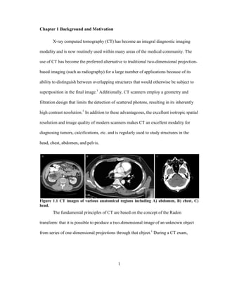 1
Chapter 1 Background and Motivation
X-ray computed tomography (CT) has become an integral diagnostic imaging
modality and is now routinely used within many areas of the medical community. The
use of CT has become the preferred alternative to traditional two-dimensional projection-
based imaging (such as radiography) for a large number of applications because of its
ability to distinguish between overlapping structures that would otherwise be subject to
superposition in the final image.1
Additionally, CT scanners employ a geometry and
filtration design that limits the detection of scattered photons, resulting in its inherently
high contrast resolution.1
In addition to these advantageous, the excellent isotropic spatial
resolution and image quality of modern scanners makes CT an excellent modality for
diagnosing tumors, calcifications, etc. and is regularly used to study structures in the
head, chest, abdomen, and pelvis.
Figure 1.1 CT images of various anatomical regions including A) abdomen, B) chest, C)
head.
The fundamental principles of CT are based on the concept of the Radon
transform: that it is possible to produce a two-dimensional image of an unknown object
from series of one-dimensional projections through that object.1
During a CT exam,
 