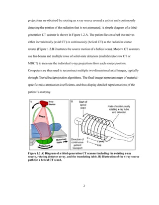 2
projections are obtained by rotating an x-ray source around a patient and continuously
detecting the portion of the radiation that is not attenuated. A simple diagram of a third-
generation CT scanner is shown in Figure 1.2.A. The patient lies on a bed that moves
either incrementally (axial CT) or continuously (helical CT) as the radiation source
rotates (Figure 1.2.B illustrates the source motion of a helical scan). Modern CT scanners
use fan-beams and multiple rows of solid-state detectors (multidetector row CT or
MDCT) to measure the individual x-ray projections from each source position.
Computers are then used to reconstruct multiple two-dimensional axial images, typically
through filtered backprojection algorithms. The final images represent maps of material-
specific mass attenuation coefficients, and thus display detailed representations of the
patient‘s anatomy.
Figure 1.2 A) Diagram of a third-generation CT scanner including the rotating x-ray
source, rotating detector array, and the translating table. B) Illustration of the x-ray source
path for a helical CT scan1.
 