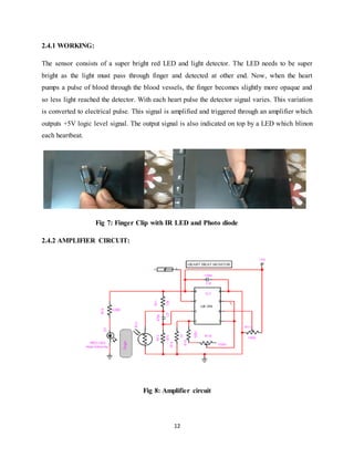 12
2.4.1 WORKING:
The sensor consists of a super bright red LED and light detector. The LED needs to be super
bright as the light must pass through finger and detected at other end. Now, when the heart
pumps a pulse of blood through the blood vessels, the finger becomes slightly more opaque and
so less light reached the detector. With each heart pulse the detector signal varies. This variation
is converted to electrical pulse. This signal is amplified and triggered through an amplifier which
outputs +5V logic level signal. The output signal is also indicated on top by a LED which blinon
each heartbeat.
Fig 7: Finger Clip with IR LED and Photo diode
2.4.2 AMPLIFIER CIRCUIT:
Fig 8: Amplifier circuit
 
