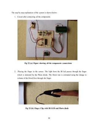 30
The step by step explanation of the system is shown below:
1. Circuit after connecting all the components.
Fig 22 (a): Figure showing all the components connections
2. Placing the finger in the sensor. The light form the IR led passes through the finger
which is detected by the Photo diode. The Herat rate is estimated using the change in
volume of the blood flow through the finger.
Fig 22 (b): Finger Clip with IR LED and Photo diode
 