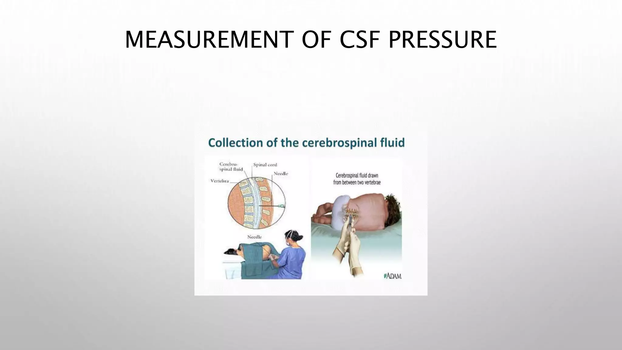MEASUREMENT OF CSF PRESSURE
 