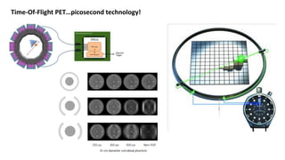 Time-Of-Flight PET…picosecond technology!
 