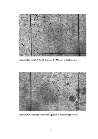 37
Sample taken from left thumb that aged for 48 hours using Sequence 1
Sample taken from right thumb that aged for 48 hours using Sequence 1
 