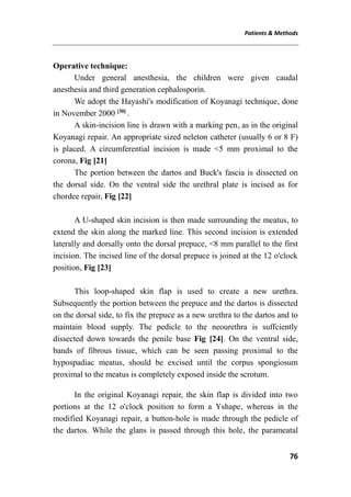 Patients & Methods
76
Operative technique:
Under general anesthesia, the children were given caudal
anesthesia and third generation cephalosporin.
We adopt the Hayashi's modification of Koyanagi technique, done
in November 2000 [30]
.
A skin-incision line is drawn with a marking pen, as in the original
Koyanagi repair. An appropriate sized neleton catheter (usually 6 or 8 F)
is placed. A circumferential incision is made <5 mm proximal to the
corona, Fig [21]
The portion between the dartos and Buck's fascia is dissected on
the dorsal side. On the ventral side the urethral plate is incised as for
chordee repair, Fig [22]
A U-shaped skin incision is then made surrounding the meatus, to
extend the skin along the marked line. This second incision is extended
laterally and dorsally onto the dorsal prepuce, <8 mm parallel to the first
incision. The incised line of the dorsal prepuce is joined at the 12 o'clock
position, Fig [23]
This loop-shaped skin flap is used to create a new urethra.
Subsequently the portion between the prepuce and the dartos is dissected
on the dorsal side, to fix the prepuce as a new urethra to the dartos and to
maintain blood supply. The pedicle to the neourethra is suffciently
dissected down towards the penile base Fig [24]. On the ventral side,
bands of fibrous tissue, which can be seen passing proximal to the
hypospadiac meatus, should be excised until the corpus spongiosum
proximal to the meatus is completely exposed inside the scrotum.
In the original Koyanagi repair, the skin flap is divided into two
portions at the 12 o'clock position to form a Yshape, whereas in the
modified Koyanagi repair, a button-hole is made through the pedicle of
the dartos. While the glans is passed through this hole, the parameatal
 