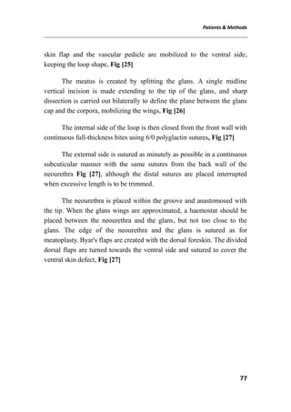 Patients & Methods
77
skin flap and the vascular pedicle are mobilized to the ventral side,
keeping the loop shape, Fig [25]
The meatus is created by splitting the glans. A single midline
vertical incision is made extending to the tip of the glans, and sharp
dissection is carried out bilaterally to define the plane between the glans
cap and the corpora, mobilizing the wings, Fig [26]
The internal side of the loop is then closed from the front wall with
continuous full-thickness bites using 6/0 polyglactin sutures, Fig [27]
The external side is sutured as minutely as possible in a continuous
subcuticular manner with the same sutures from the back wall of the
neourethra Fig [27], although the distal sutures are placed interrupted
when excessive length is to be trimmed.
The neourethra is placed within the groove and anastomosed with
the tip. When the glans wings are approximated, a haemostat should be
placed between the neourethra and the glans, but not too close to the
glans. The edge of the neourethra and the glans is sutured as for
meatoplasty. Byar's flaps are created with the dorsal foreskin. The divided
dorsal flaps are turned towards the ventral side and sutured to cover the
ventral skin defect, Fig [27]
 