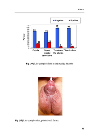 RESULTS
95
80
20
75
25
95
5
95
5
0
10
20
30
40
50
60
70
80
90
100
110
Percent
Fistula Site of
meatal
recession
Torsion of
the glands
Diverticulum
Negative Positive
Fig [39] Late complications in the studied patients
Fig [40] Late complication, penoscrotal fistula.
 