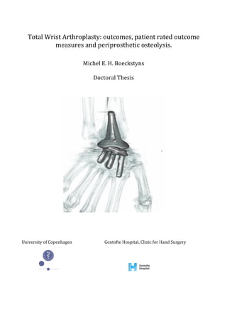 Total	
  Wrist	
  Arthroplasty:	
  outcomes,	
  patient	
  rated	
  outcome	
  
measures	
  and	
  periprosthetic	
  osteolysis.	
  
	
  
	
  
Michel	
  E.	
  H.	
  Boeckstyns	
  
	
  
Doctoral	
  Thesis	
  
	
  
	
  
	
  
	
  
	
  
	
  
	
  
	
  
	
  
University	
  of	
  Copenhagen	
   	
  	
  	
  	
  	
  	
  	
  	
  Gentofte	
  Hospital,	
  Clinic	
  for	
  Hand	
  Surgery	
  
	
  	
  	
  	
  	
  	
  	
  	
  	
   	
   	
   	
   	
  
	
  	
  	
  	
  	
  	
  	
  	
  	
  	
  	
  	
  	
  	
  	
  	
  	
   	
  	
  	
  	
  	
  	
  	
  	
  	
  	
  	
  	
  	
  	
  	
  	
  	
  	
  	
  	
  	
  	
  	
  	
   	
  	
  	
  	
  	
  	
  	
  	
  	
  	
  	
  	
  	
  	
  	
  	
  	
  	
  	
  	
  	
  	
  	
  	
  	
  	
  	
  	
  	
  	
  	
  	
   	
  
	
   	
  
 