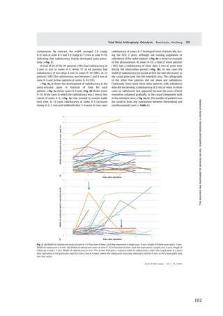   102	
  
	
  
	
   	
  
components. By contrast, the width averaged 2.0 (range
0–9) mm at zone 4–5 and 1.0 (range 0–7) mm at zone 9–10,
indicating that radiolucency mainly developed juxta-articu-
larly (►Fig. 2).
A total of 26 of the 44 patients (59%) had radiolucency of
2 mm or less in zones 4–5, while 37 of 44 patients had
radiolucency of less than 2 mm in zones 9–10 (84%). In 15
patients (34%) the radiolucency was between 2 and 4 mm at
zone 4–5 and in four patients at zones 9–10 (9%).
►Fig. 3a, b shows the development of radiolucency at the
juxta-articular spots in function of time for each
patient: ►Fig. 3a shows zones 4–5 and ►Fig. 3b shows zones
9–10. In the cases in which the radiolucency was 2 mm or less
(mean of zones 4–5, ►Fig. 3a) this seemed to remain stable
over time. In 14 cases radiolucency at zones 4–5 increased
slowly to 2–3 mm and stabilized after 3–4 years. In two cases
radiolucency at zones 4–5 developed more dramatically dur-
ing the ﬁrst 2 years, although not causing angulation or
subsidence of the radial implant. ►Fig. 4a–c shows an example
of this phenomenon. At zones 9–10, a total of seven patients
(16%) had a radiolucency of more than 2 mm at some time
during the observation period (►Fig. 3b). In two cases the
width of radiolucency increased at ﬁrst but later decreased, as
the carpal plate sank into the osteolytic area. The radiographs
of the other ﬁve patients did not show any subsidence.
Conversely, there were three other patients with subsidence
who did not develop a radiolucency of 2 mm or more. In these
cases no radiolucent line appeared because the zone of bone
resorption collapsed gradually, as the carpal component sank
in the osteolytic area (►Fig. 5a, b). The number of patients was
too small to draw any conclusions between rheumatoid and
nonrheumatoid cases (►Table 2).
Fig. 3 (a) Width of radiolucent zones at zone 4–5 in function of time. Each line represents a single case. X-axis: length of follow-up in years. Y-axis:
Width of radiolucency in mm. (b) Width of radiolucent zones at zone 9–10 in function of time. Each line represents a single case. X-axis: length of
follow-up in years. Y-axis: Width of radiolucency in mm. The arrows indicates a maximal width of radiolucency under the carpal plate at 2 years
after operation in this particular case (6.2 mm), and at 4 years, where the radiolucent zone was reduced to almost 0 mm, as the carpal plate sank
into the carpus
Journal of Wrist Surgery Vol. 3 No. 2/2014
Total Wrist Arthroplasty: Osteolysis Boeckstyns, Herzberg 103
Thisdocumentwasdownloadedforpersonaluseonly.Unauthorizeddistributionisstrictlyprohibited.
 