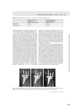   104	
  
	
  
	
   	
  
articulate with each other. This resorption seems to stabilize
after 6–12 months and is ascribed to stress shielding.27,28
In our series, juxta-articular radiolucency larger than
2 mm was seen in 18 of 44 cases (41%), in 11 at the radial
side only, in two at the carpal side only, and in ﬁve at both
sides: In some patients it was visible already 1 year after
operation, while in other patients it did not appear at all, even
6 years after operation (►Figs. 3a, b). We attempted to treat
one of the cases that developed radiolucency without loos-
ening of the implant, by bone grafting, because this rheuma-
toid patient presented with an increasing cystic ganglion at
the dorsum of the wrist. Radiolucency recurred within 2 years
(►Fig. 6a–c). No samples were collected for histopathological
examination in this case. The main strength of our study is
that we have followed a consecutive group of patients with
annual radiographical examinations,. We were able to answer
the questions formulated in the introduction of this paper
with reasonable validity. We found signiﬁcant periprosthetic
radiolucency, more than 2 mm in width, relatively frequent-
ly: at the radial component side in 36% of the cases and at the
carpal component side in 16%. It developed gradually juxta-
articularly around the prosthetic components during the ﬁrst
years after operation, regardless of the primary diagnosis, and
seemed to stabilize in most patients after 1–3 years at a level
of a few mm. In a small percentage of the patients, the
periprosthetic area of bone resorption was markedly larger.
This number of patients is too small to indicate clearly
whether it stabilizes after 2–3 years or is continuously
progressing. On the other hand, radiolucency did not at all
develop at the extremities of the components to the same
extent as near the joint and in general was not clearly related
to evident loosening (angulation or subsidence over time):
only one radial component was loose at latest follow-up, and
only two of the carpal implants with major periprosthetic
bone resorption had subsided. Weaknesses of this study
include the fact that the examiners were not blinded and
there was no calculation of intraobserver agreement. We did
not perform histology to rule out osteolysis possibly due to
polyethylene wear particles.
Our data, based on a single metal-on-polyethylene im-
plant, do not allow us to draw any conclusion on the possible
causes of bone resorption without implant loosening. From
the literature cited above, several possible mechanisms could
play a role: metallic or polyethylene-induced osteolysis or
stress-shielding. The mere simultaneous occurrence of debris
and radiolucency is not in itself a proof of a causal relationship
between these two phenomena. Further investigations are
necessary to elucidate the question. It is difﬁcult to infer any
practical consequence of our ﬁndings for the time being. So
far, we have adopted the policy of not revising implants with
PPO in patients who did not have pain. Our single case that
was bone-grafted and in which the PPO recurred rapidly does
not prompt us to recommend this procedure. We are inclined
to recommend close observation of these cases, at least until
it is clear whether they stabilize or continue to progress,
which increases the chances of implant loosening.
Table 2 Width of radiolucent zone at zones 4–5 and zones 9–10 in different diagnostic groups
Width of radiolucency
at zone 4–5
(mean of zones 4 and 5)
Width of radiolucency
at zone 9-10 (mean of
zones 9 and 10)
Rheumatoid 2.1 mm 0.8 mm
Nonrheumatoid 1.7 mm 0.8 mm
Fig. 6 (a) Periprosthetic radiolucency, conﬁned to the juxta-articular periprosthetic areas, 6 years after TWA. (b) Same case as in a, after bone
grafting under the carpal plate. (c) Recurrent radiolucency under the carpal plate 2 years after bone grafting. No subsidence.
Journal of Wrist Surgery Vol. 3 No. 2/2014
Total Wrist Arthroplasty: Osteolysis Boeckstyns, Herzberg 105
Thisdocumentwasdownloadedforpersonaluseonly.Unauthorizeddistributionisstrictlyprohibited.
 
