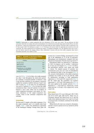   110	
  
	
  
zone 4 to 5 (Fig. 2). In 6 of these, the width remained
less than 2 mm throughout the observation period.
In 3 patients it increased initially to between 3 and
4 mm and then stabilized. In one patient it increased
rapidly but seemed to stabilize between 8 and 9 mm
after 4 years (Fig. 3). In zones 9 to 10 radiolucency
was seen in 7 patients (Fig. 2). In 4 of these the width
remained less than 1 mm. In 3 patients it increased to
between 3 and 4 mm. There was no evidence of
radial component loosening in any patient. In 3 pa-
tients subsidence of the carpal component was
evident. None of the cemented components had
subsided.
Histopathology
We harvested 13 samples at the radial component, 10 at
the carpal component, and 1 at a metallic ulnar head
implant. Table 3 shows the interobserver agreement
of the histological ﬁndings. Foreign body giant cell
reaction was a common ﬁnding, encountered by at least
one of the pathologists in 15 of the 24 specimens.
Macrophages were predominant compared with lym-
phocytesin22specimens.Necrotictissue wasseenin 17.
Polyethylene debris was detected in 17 specimens
by both investigators and in another 2 specimens
by at least one investigator (Fig. 4). In 11 of these,
the polyethylene particles were sparse and small
or minute. No marked amount of particles was
encountered in any case. In 5 cases no polyethylene
was identiﬁed by either of the investigators (Fig. 4).
The amount of polyethylene at the radial component
correlated very weakly or not at all with the width
of radiolucency according to both pathologists
(Spearman r, e0.16 and 0.18, respectively) (Fig. 5).
On the carpal side, the correlation was negative
(Spearman r, e0.55 and -0.69 respectively) (Fig. 6).
The same applied to the metallic particles (Fig. 4):
Spearman r ¼ e0.26 and 0.12, respectively, on the
radial side and e0.18 and e0.26, respectively, on the
carpal side.
Blood analyses
Mean blood level of Cr was 0.264 mg/L (SD, 0.384)
and of Co 0.253 mg/L (SD, 0.275). There was no
correlation between the blood level of Cr and the
width of the radiolucent zones 4 to 5 and 9 to 10 and
a reversed weak or moderate correlation for the blood
level of Co.
White blood cell count was normal in all patients,
and the C-reactive protein level was normal in all but
one patient.
FIGURE 3: Radiographs in a patient undergoing total wrist arthroplasty. A Two weeks after surgery. The peg penetrates the third
metacarpal, which does not comply with usual recommendations but resulted from an unusually large carpal resection. B Four years after
the operation. A large area of periprosthetic osteolysis has developed under the radial component. The mean width of radiolucency was
8.5 mm at spots 4 and 5. No radiolucency at spots 1, 2, or 3. Osteolysis is also present under the carpal plate and around the screws and
central peg. The carpal component has not subsided since surgery. C Computed tomography scan. The radiolucent lines seen at zone 2
and 3are artifacts caused by the imaging software. Bone condensation is present at the tip of the radial component where load is
transmitted maximally from implant to bone.
TABLE 3. Reliability of Histological Findings
(Agreement Between 2 Pathologists)
Findings k
Necrotic tissue 0.68
Metal particles 0.59
Polyethylene debris 0.78
Preponderance of macrophages
compared with lymphocytes
1.00
Foreign body reaction 0.74
2400 WEAR PARTICLES AND OSTEOLYSIS AFTER TOTAL WRIST ARTHROPLASTY
J Hand Surg Am. r Vol. 39, December 2014
 