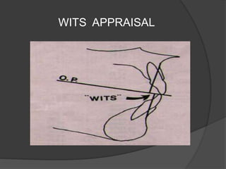 WITS APPRAISAL

 