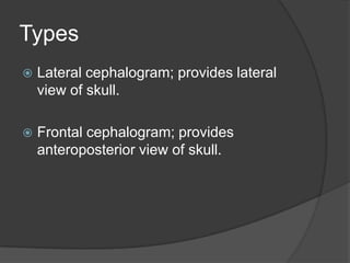 Types


Lateral cephalogram; provides lateral
view of skull.



Frontal cephalogram; provides
anteroposterior view of skull.

 