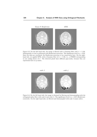 2I
↓ • xi+2[k]
Figure 5.4: Analysis part of the 2D QWT for two iterations.
2
1y
y3
y4
x4
y
Figure 5.5: Formation of quincunx coeﬃcients for 4 iterations.
The major objection that can be made to our construction is that the ﬁlters are not
FIR and that it may be diﬃcult and costly to implement the transform in practice. We
will see here that we can turn the situation around and obtain a very simple and eﬃcient
algorithm that is based on the FFT, following the idea of [117]. Working in the frequency
domain is also very convenient because of the way in which we have speciﬁed our ﬁlters
 
