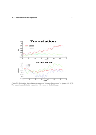 5.5. Experiments 87
original of “cameraman”
λ = 2.1 λ = 14
(a) (b)
Figure 5.10: Reconstruction of the “cameraman” with the 10000 largest coeﬃcients with an
order parameter a) λ = 2.1 and b) λ = 14.
 