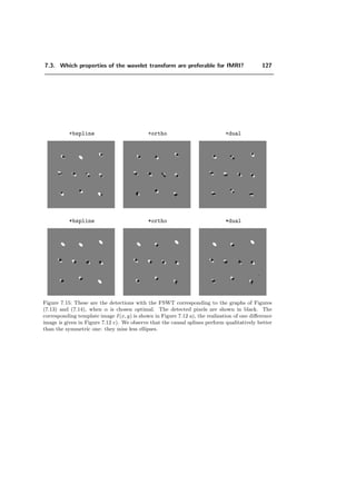 6.5. Results 103
We bound the second term as follows:
r ≤
k
|h[nM − k]h[n M − k]|(sup 2|ε[k]| + sup ε[k]2
)
≤
k
h[nM − k]2
k
h[n M − k]2
= 1
M
(sup 2|ε[k]| + sup ε[k]2
) (Cauchy-Schwartz)
≤
1
M
sup 2|ε[k]| + sup ε[k]2
.
So that
E [z[n]z[n ]] = σ2
(δ[n − n ] + ρ[n, n ]),
where
|ρ[n, n ]| ≤
2
M
sup |ε[k]| + sup ε[k]2
1.
Thus, in both cases, z[n] remains essentially uncorrelated.
This theorem implies that the noise remains uncorrelated in every homogeneous zones
(σ = constant). However, the correlation property is not valid anymore on the border
of zones, like the border of the brain against the background, over a band that has the
width of the “eﬃcient” length of the ﬁlter G.
6.5 Results
To illustrate the technique, we present some examples of real data analysis (cf. Figures 6.3
to 6.4). The data set is obtained from HUG and has the speciﬁcation described in
Table 7.4. The task was watching a moving checker board of colors. After orthogonal
ﬁltering and applying the Bonferroni-correction, we detect activity in the occipital lobe
(cf. Section 2.9). We also applied SPM [156] with a σ corresponding to the smoothing
factor of the orthogonal ﬁlter (Figure 6.3). The diﬀerence between our detection and
SPM is not negligible. The activation of the right hemisphere of the brain seems to be
comparable. However, in the left hemisphere, we detect an additional activation on the
border (cf. Figure 6.4). Applying a Gaussian ﬁlter of the same width as in SPM and
performing a t-test with Bonferroni-correction, we could conﬁrm this detection. It is
unclear why SPM did not detect this pattern.
6.6 Conclusion
We have proposed a ﬁrst approach that simpliﬁes the statistical analysis of the data, as
compared to SPM. The idea is to continue “orthogonal” smoothing with down-sampling
 