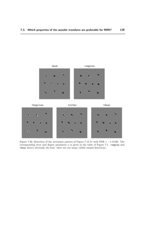 7.3. Which properties of the wavelet transform are preferable for fMRI? 115
domain Iest,W (x, y) and the estimated activation pattern Iest(x, y) after applying the
threshold level to the output of the synthesis part. A data set is then reconstructed by
adding a noise of level σ (N(0, σ)) to Iest(x, y) . Detection is performed again yielding an
estimated activation pattern ˜Iest,W (x, y). When the value of level is chosen adequately,
Iest,W (x, y) and ˜Iest,W (x, y) should match. A distance map to measure the matching
error between Iest,W (x, y) and ˜Iest,W (x, y) is evaluated :
dest,W =



0, (x, y) is in the same activation state in Iest,W and in ˜Iest,W
1, otherwise
This process is repeated r-times by adding each time a diﬀerent realization of noise to
Iest(x, y). The ﬁnal measure is given by:
d(Iest,W , ˜Iest,W ) =
x,y
1
r
r
i=1
d
(i)
est,W (x, y) (7.1)
N (0, σ)
˜Iest,W (x, y)
Al
AhSh
SlAl
Ah
level
Iest(x, y)
Iest,W (x, y)IDτ (x, y)
Figure 7.6: Scheme of a test procedure to ensure the consistency of the threshold level. Al and
Ah represent the analysis part of the wavelet transform and the statistical testing of the wavelet
coeﬃcients. The output of these branches is Iest,W (x, y). Sl and Sh represent the synthesis
part of the wavelet transform, which is applied to Iest,W (x, y). The output of the synthesis
part is then thresholded above “level” which yields Iest(x, y). Adding noise with variance σ2
to Iest(x, y) creates a new data set. The thresholding procedure is consistent whenever, on
the average over all possible realizations of the resynthesized noise, Iest,W (x, y) and ˜Iest,W (x, y)
match. In practice, we average over 130 realizations.
7.3 Which properties of the wavelet transform are prefer-
able for fMRI?
In order to investigate the inﬂuence of the structure parameters of the algorithm —its (bi-
) orthogonality, symmetry / causality, its order of approximation, its iteration depth J
etc.— an error measure must ﬁrst be deﬁned between the true activation and that which
 