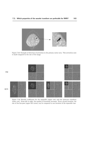 7.3. Which properties of the wavelet transform are preferable for fMRI? 119
E1 and E2, the true-positive ratio is equal to (1 − E2) and the false-positive ratio is
proportional to E1. It is the denominator of the deﬁnition of these measures that makes
the diﬀerence: compare (7.2) with:
false positive ratio = E1
Card(A)
Card(Ac)
(7.3)
Thus, the ROC-curve, compared to our measures is:
ROC(γ) =
1 − E2(γ)
E1(γ) Card(A)
Card(Ac)
where γ ∈ [0%, 100%]. (7.4)
We believe that it is more reasonable to express the false detections (E1) relative to A,
rather than Ac
because then: (i) the quantity E1 and E2 are comparable (ii) E1 does
not depend on the image size and (iii) a larger activation zone is likely to cause more
false activations. In Figure 7.10 such a ROC curve is illustrated in terms of E1 and E2.
Minimizing E amounts to maximizing 1 − E, i.e., the distance between the ROC-curve
and the locus of random detection, which represents 1−E = 1−E2−E1 = 0. When the
curve lies below the locus of random detection, the minimal error is the minimal distance
of the ROC-curve to this diagonal. A ﬁeld where these error measures are intensively
40%
1 − E = 0
E1
80%40%20%0%
0%
20%
1 − E
60%
80%
EER
1−E2
ROC
E1 = E2
Figure 7.10: Comparison of Receiver Operator Characteristic (ROC), the Equal Error Rate
(EER) and our error measure (E).
studied is biometrics, the ﬁeld of automatic identity veriﬁcation methods, such as voice,
face, eyes or ﬁngerprint identiﬁcation. They cope with the False Rejection Rate (FRR),
which is equal to our E2 and with False Acceptance Rate (FAR) which is equal to the
false positive ratio. In this ﬁeld, the Equal Error Rate (EER), given by E1 = E2 on the
ROC-curve, is often used as a performance measure; see the position compared to the
 