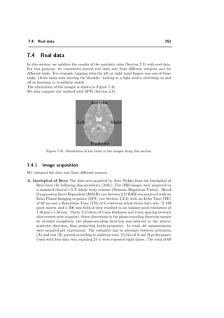 7.3. Which properties of the wavelet transform are preferable for fMRI? 127
+bspline +ortho +dual
*bspline *ortho *dual
Figure 7.15: These are the detections with the FSWT corresponding to the graphs of Figures
(7.13) and (7.14), when α is chosen optimal. The detected pixels are shown in black. The
corresponding template image I(x, y) is shown in Figure 7.12 a), the realization of one diﬀerence
image is given in Figure 7.12 c). We observe that the causal splines perform qualitatively better
than the symmetric one: they miss less ellipses.
 