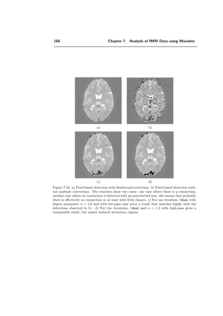 142 Chapter 7. Analysis of fMRI Data using Wavelets
sep
λ = 2 λ = 6
0 0.1 0.2 0.3 0.4 0.5
0
0.5
1
1.5
normalized frequency
0 0.1 0.2 0.3 0.4 0.5
0
0.5
1
1.5
normalized frequency
Figure 7.30: Example of frequency response of the low-pass (solid line) and high-pass (dashed
line) ﬁlters for the one dimensional design Hλ(ω) (sep).
|H|
ω2
ω1
Hλ=1(ω) Hλ=6(ω)
Figure 7.31: Example of frequency response of the quincunx low-pass ﬁlter.
 