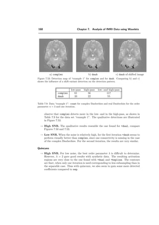 144 Chapter 7. Analysis of fMRI Data using Wavelets
I(x, y)
zoom of I(x, y) quin sep
(a) (b) (c)
Figure 7.34: I(x, y) contains several patterns to detect. The level of noise is SNR = 2.5dB for
IDτ . For each method the results are presented for the optimal order parameter λ, which causes
the smallest error E. The white pixels represent the pattern. In b) and c) the black pixels
represent the detection. b) Representation of the detection of one of those patterns for quin.
The errors are relatively few compared to the small size of the pattern. With this low level of
noise, one iteration is suﬃcient. c) Representation of the qualitative result for the separable
algorithm for the same zoomed pattern.
 