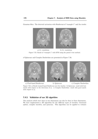 146 Chapter 7. Analysis of fMRI Data using Wavelets
0 2 4 6 8
20
30
40
50
60
70
80
90
100
110
order λ
detectionerrorsE(α)in%
quin
sep
0 2 4 6 8
0
20
40
60
80
100
order λ
falsedetectionsE1(α)in%
quin
sep
0 2 4 6 8
0
20
40
60
80
100
order λ
misseddetectionsE2(α)in%
quin
sep
a) E b) E1 c) E2
Figure 7.36: Detection error percentage of the data of Figure 7.22 b). quin detects with less
errors since it can take advantage of its odd iteration depth (J = 3). The better result is mainly
due to less false detections E1.
I(x, y) quin sep
Figure 7.37: I(x, y) is extracted from a slice of real data. The level of noise added to I(x, y)
results in an SNR = 14.8dB for ¯ID. The order parameter λ for quin and sep is chosen such
that the error E is minimal.
This is reasonable insofar as the optimum iteration depth for quin is lower com-
pared to the separable case and thus the low-pass is of larger size. The graph of
the numbers of detected coeﬃcients corresponding to Figure 7.37 is presented in
Figure 7.38. The number of detections in the high-pass depends highly on the order
λ. It could be observed with the experiments of ellipses that the lower the order
the more detections are obtained in the high-pass. This is due to the decrease
 