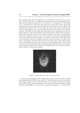 12 Chapter 2. Functional Magnetic Resonance Imaging (fMRI)
PET imaging begins with the injection of a metabolically active tracer into the pa-
tient. The tracer is built by a biological molecule that carries a positron-emitting isotope
(known as the radioactive tag), such as 11
C (carbon-11), 18
F (ﬂuorine-18), 15
O (oxygen-
15) or 13
N (nitrogen-13), which have short decay times. Over a few minutes, the isotope
accumulates in an area of the body for which the carrier molecule has an aﬃnity. For
example, glucose labeled with 11
C accumulates in the brain or in tumors where glucose
is used as the primary source of energy. The radioactive nuclei then decay by positron
emission. Thus PET provides images of biochemical functions, depending upon the type
of molecule that is radioactively tagged. The emitted positron combines with an electron
almost instantaneously, and these two particles experience the process of annihilation.
The energy associated with the masses of the positron and electron is divided equally
between two photons that ﬂy away from one another at a 180◦
angle. These high-energy
γ-rays emerge from the body in opposite directions and are detected by an array of cir-
cular γ-ray detectors that surround the body of the patient [24]. These detectors have
a series of scintillation crystals, each connected to a photomultiplier tube. The crystals
convert the γ-rays to photons, which the photomultiplier tubes convert to electrical sig-
nals and amplify. These electrical signals are then processed by the computer to generate
images. Figure 2.7 shows such an image.
Figure 2.7: PET image from a slice of the human brain.
There are some limitations of PET. Higher order cognitive processes increase regional
Cerebral Blood Flow (rCBF) by only about 5%. This small amount can only be detected
when multiple subjects are used and this relates to the problem of anatomical variation
between the subjects. Another limitation are the spatial and temporal resolutions, which
are lower than for fMRI, i.e., 3 mm and 60 s, respectively, compared to ∼ 1.5 mm and 100
 