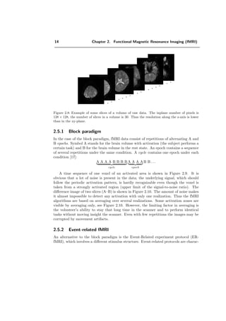 14 Chapter 2. Functional Magnetic Resonance Imaging (fMRI)
. .
. . . .
. .
. . . .
. .
Figure 2.8: Example of some slices of a volume of raw data. The inplane number of pixels is
128 × 128, the number of slices in a volume is 30. Thus the resolution along the z-axis is lower
than in the xy-plane.
2.5.1 Block paradigm
In the case of the block paradigm, fMRI data consist of repetitions of alternating A and
B epochs. Symbol A stands for the brain volume with activation (the subject performs a
certain task) and B for the brain volume in the rest state. An epoch contains a sequence
of several repetitions under the same condition. A cycle contains one epoch under each
condition [17]:
A A A A B B B B
cycle
A A A A
epoch
B B . . .
A time sequence of one voxel of an activated area is shown in Figure 2.9. It is
obvious that a lot of noise is present in the data; the underlying signal, which should
follow the periodic activation pattern, is hardly recognizable even though the voxel is
taken from a strongly activated region (upper limit of the signal-to-noise ratio). The
diﬀerence image of two slices (A–B) is shown in Figure 2.10. The amount of noise makes
it almost impossible to detect any activation with only one realization. Thus the fMRI
algorithms are based on averaging over several realizations. Some activation zones are
visible by averaging only, see Figure 2.10. However, the limiting factor in averaging is
the volunteer’s ability to stay that long time in the scanner and to perform identical
tasks without moving insight the scanner. Even with few repetitions the images may be
corrupted by movement artifacts.
2.5.2 Event-related fMRI
An alternative to the block paradigm is the Event-Related experiment protocol (ER-
fMRI), which involves a diﬀerent stimulus structure. Event-related protocols are charac-
 