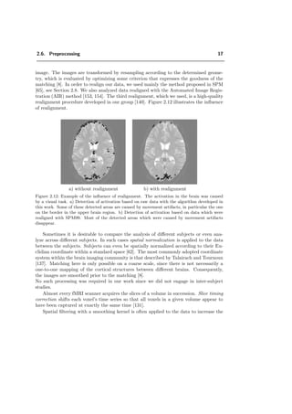 2.6. Preprocessing 17
image. The images are transformed by resampling according to the determined geome-
try, which is evaluated by optimizing some criterion that expresses the goodness of the
matching [8]. In order to realign our data, we used mainly the method proposed in SPM
[65], see Section 2.8. We also analyzed data realigned with the Automated Image Regis-
tration (AIR) method [153, 154]. The third realignment, which we used, is a high-quality
realignment procedure developed in our group [140]. Figure 2.12 illustrates the inﬂuence
of realignment.
a) without realignment b) with realignment
Figure 2.12: Example of the inﬂuence of realignment. The activation in the brain was caused
by a visual task. a) Detection of activation based on raw data with the algorithm developed in
this work. Some of these detected areas are caused by movement artifacts, in particular the one
on the border in the upper brain region. b) Detection of activation based on data which were
realigned with SPM99. Most of the detected areas which were caused by movement artifacts
disappear.
Sometimes it is desirable to compare the analysis of diﬀerent subjects or even ana-
lyze across diﬀerent subjects. In such cases spatial normalization is applied to the data
between the subjects. Subjects can even be spatially normalized according to their Eu-
clidian coordinate within a standard space [62]. The most commonly adopted coordinate
system within the brain imaging community is that described by Talairach and Tournoux
[137]. Matching here is only possible on a coarse scale, since there is not necessarily a
one-to-one mapping of the cortical structures between diﬀerent brains. Consequently,
the images are smoothed prior to the matching [8].
No such processing was required in our work since we did not engage in inter-subject
studies.
Almost every fMRI scanner acquires the slices of a volume in succession. Slice timing
correction shifts each voxel’s time series so that all voxels in a given volume appear to
have been captured at exactly the same time [131].
Spatial ﬁltering with a smoothing kernel is often applied to the data to increase the
 