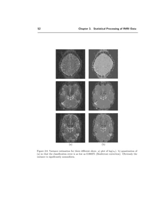 52 Chapter 3. Statistical Processing of fMRI Data
(a) (b)
Figure 3.8: Variance estimation for three diﬀerent slices: a) plot of log(sk). b) quantization of
(a) so that the classiﬁcation error is as low as 0.0003% (Bonferroni correction). Obviously the
variance is signiﬁcantly nonuniform.
 