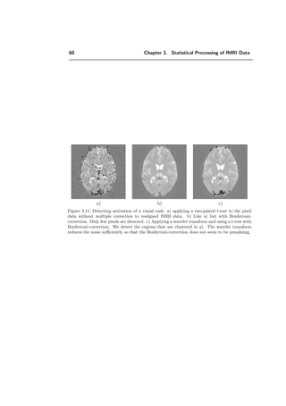 60 Chapter 3. Statistical Processing of fMRI Data
a) b) c)
Figure 3.11: Detecting activation of a visual task: a) applying a two-paired t-test to the pixel
data without multiple correction to realigned fMRI data. b) Like a) but with Bonferroni-
correction. Only few pixels are detected. c) Applying a wavelet transform and using a t-test with
Bonferroni-correction. We detect the regions that are clustered in a). The wavelet transform
reduces the noise suﬃciently so that the Bonferroni-correction does not seem to be penalizing.
 