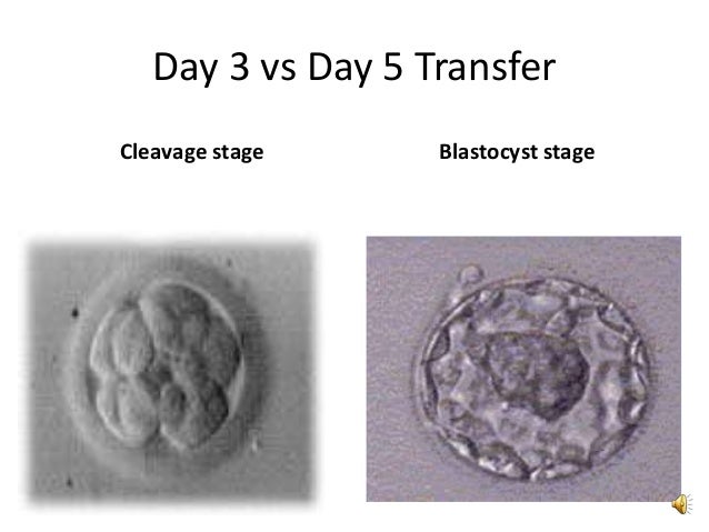 The Ivf Journey