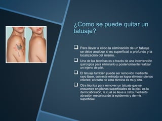 ¿Como se puede quitar un
tatuaje?
 Para llevar a cabo la eliminación de un tatuaje
se debe analizar si es superficial o profundo y la
localización del mismo.
 Una de las técnicas es a través de una intervención
quirúrgica para eliminarlo y posteriormente realizar
un injerto de piel.
 El tatuaje también puede ser removido mediante
rayo láser, con este método se logra eliminar ciertos
colores; el costo de esta técnica es muy alto.
 Otra técnica para remover un tatuaje que se
encuentra en planos superficiales de la piel, es la
dermoabrasión, la cual se lleva a cabo mediante
abrasión mecánica de la epidermis y dermis
superficial.
 