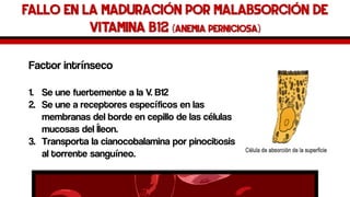 Fallo en la maduración por malabsorción de Vitamina B12 (anemia perniciosa) 
Factor intrínseco 
1.Se une fuertemente a la V. B12 
2.Se une a receptores específicos en las membranas del borde en cepillo de las células mucosas del Íleon. 
3.Transporta la cianocobalaminapor pinocitosis al torrente sanguíneo.  