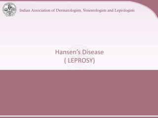 Hansen’s Disease
( LEPROSY)
 