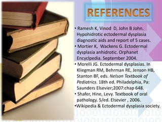 • Ramesh K, Vinod D, John B John.
Hypohidrotic ectodermal dysplasia
diagnostic aids and report of 5 cases.
• Mortier K, Wackens G. Ectodermal
dysplasia anhidrotic. Orphanet
Encyclpedia. September 2004.
• Morelli JG. Ectodermal dysplasias. In
Kliegman RM, Behrman RE, Jenson HB,
Stanton BF, eds. Nelson Textbook of
Pediatrics. 18th ed. Philadelphia, Pa:
Saunders Elsevier;2007:chap 648.
• Shafer, Hine, Levy. Textbook of oral
pathology. 5/ed. Elsevier , 2006.
•Wikipedia & Ectodermal dysplasia society.
 