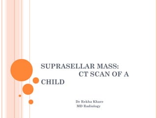 SUPRASELLAR MASS:
CT SCAN OF A
CHILD
Dr Rekha Khare
MD Radiology
 