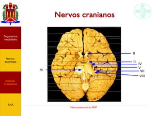 Neuroanatomia do SNP
Nervos cranianos
Nervos
cranianos
Nervos
espinhais
Segmentos
medulares
SNA
VI
II
III
IV
V
VII
VIII
 