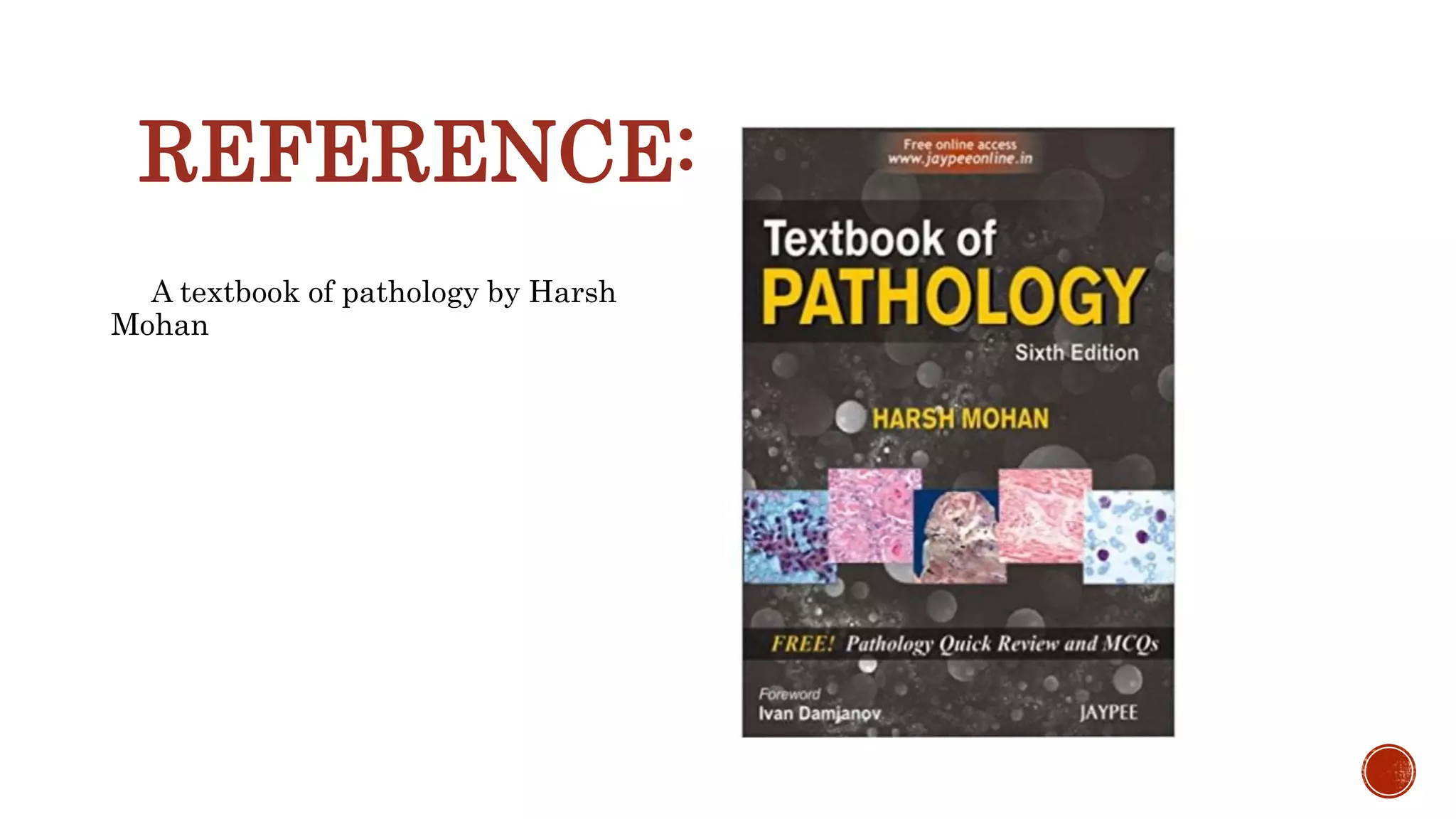 REFERENCE:
A textbook of pathology by Harsh
Mohan
 