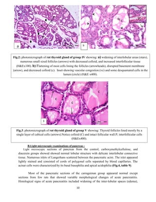 10
B-Light microscopic examinations of pancreas :
Light microscopic sections of pancreas from the control, carboxymethylcellulose, and
diacerein groups showed showed normal lobular structure with delicate interlobular connective
tissue. Numerous islets of Langerhans scattered between the pancreatic acini. The islet appeared
lightly stained and consisted of cords of polygonal cells separated by blood capillaries. The
acinar cells were characterized by its basal basophilia and apical acidophilia (Fig.4, table 9).
Most of the pancreatic sections of the carrageenan group appeared normal except
sections from few rats that showed variable morphological changes of acute pancreatitis.
Histological signs of acute pancreatitis included widening of the inter-lobular spaces (edema),
a b
b
c
vc
Fig.2: photomicrograph of rat thyroid gland of group IV showing: a) widening of interlobular areas (stars),
numerous small sized follicles (arrows) with decreased colloid, and increased interfollicular tissue
(H&Ex100). b) Flattening of most cells lining the follicles (arrowheads), disrupted basement membrane
(arrow), and decreased colloid (c). Inset showing vascular congestion (vc) and some desquamated cells in the
lumen (circle) (H&E x400).
c
c
c
3
Fig.3: photomicrograph of rat thyroid gland of group V showing: Thyroid follicles lined mostly by a
single layer of cubical cells (arrows).Notice colloid (C) and intact follicular wall.P; interfollicular cells
(H&Ex400).
b
 