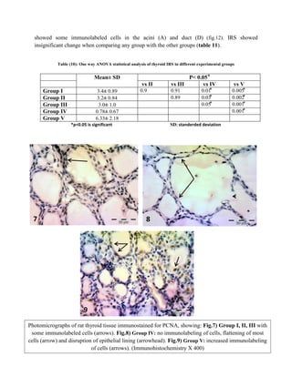 13
showed some immunolabeled cells in the acini (A) and duct (D) (fig.12). IRS showed
insignificant change when comparing any group with the other groups (table 11).
Table (10): One way ANOVA statistical analysis of thyroid IRS in different experimental groups
Mean± SD P< 0.05 ⃰
vs II vs III vs IV vs V
Group I 3.4± 0.89 0.9 0.91 0.01⃰ 0.005⃰
Group II 3.2± 0.84 0.89 0.03⃰ 0.002⃰
Group III 3.0± 1.0 0.05⃰ 0.001⃰
Group IV 0.78± 0.67 0.001⃰
Group V 6.33± 2.18
*p<0.05 is significant SD: standerded deviation
B) Pancreas
7 8
9
Photomicrographs of rat thyroid tissue immunostained for PCNA, showing: Fig.7) Group I, II, III with
some immunolabeled cells (arrows). Fig.8) Group IV: no immunolabeling of cells, flattening of most
cells (arrow) and disruption of epithelial lining (arrowhead). Fig.9) Group V: increased immunolabeling
of cells (arrows). (Immunohistochemistry X 400)
 