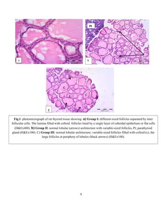 9
c
c
c c
Fig.1: photomicrograph of rat thyroid tissue showing: a) Group I: different-sized follicles separated by inter
follicular cells. The lumina filled with colloid. follicles lined by a single layer of cuboidal epithelium or flat cells
(H&Ex400). b) Group II: normal lobular (arrows) architecture with variable-sized follicles, Pt; parathyroid
gland (H&Ex100). C) Group III: normal lobular architecture; variable-sized follicles filled with colloid (c), the
large follicles at periphery of lobules (black arrows) (H&Ex100).
ba
Pt
 