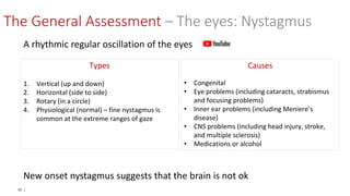 32 |
A rhythmic regular oscillation of the eyes
New onset nystagmus suggests that the brain is not ok
Types
1. Vertical (up and down)
2. Horizontal (side to side)
3. Rotary (in a circle)
4. Physiological (normal) – fine nystagmus is
common at the extreme ranges of gaze
Causes
• Congenital
• Eye problems (including cataracts, strabismus
and focusing problems)
• Inner ear problems (including Meniere’s
disease)
• CNS problems (including head injury, stroke,
and multiple sclerosis)
• Medications or alcohol
The General Assessment – The eyes: Nystagmus
 