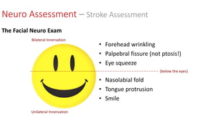 • Forehead wrinkling
• Palpebral fissure (not ptosis!)
• Eye squeeze
• Nasolabial fold
• Tongue protrusion
• Smile
(below the eyes)
Bilateral Innervation
Unilateral Innervation
The Facial Neuro Exam
Neuro Assessment – Stroke Assessment
 