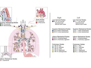 mediastinal lymph nodes anatomy (thorax) | PPTX