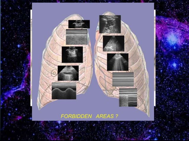 Lung Ultrasound in Critical Care and Resuscitation: Daniel Lichtenstein ...