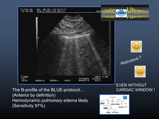 Lung Ultrasound in Critical Care and Resuscitation: Daniel Lichtenstein ...