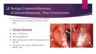 Odontogenic Tumors | PPTX